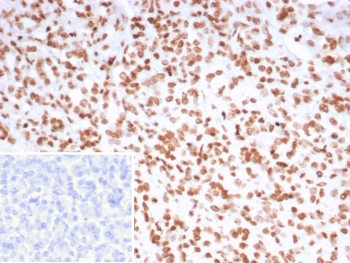 FEV Antibody / PET-1 / PC12 ETS factor 1