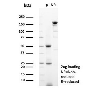 FEV Antibody / PET-1 / PC12 ETS factor 1