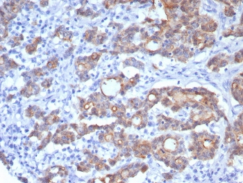 VIL1 Antibody / Villin