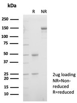 Ku80 Antibody / XRCC5