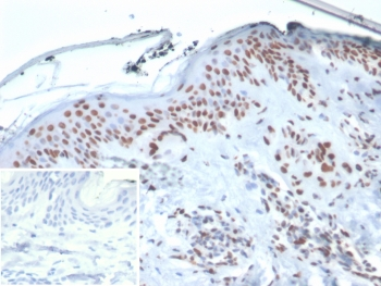 XRCC5 Antibody