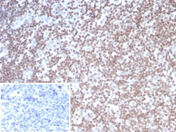 SMARCAL1 Antibody