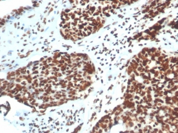Ku80 Antibody / XRCC5