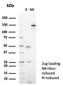 Ku80 Antibody / XRCC5