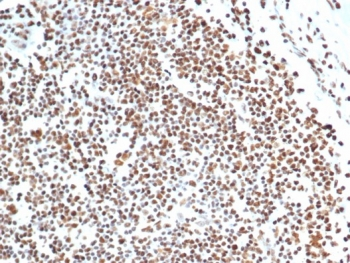 Ku80 Antibody / XRCC5