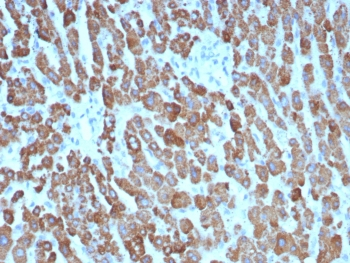 Carbamoyl-Phosphate Synthetase Antibody / CPS1