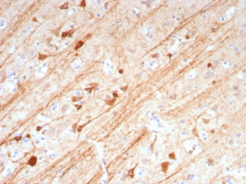 MAP2 Antibody / Microtubule-associated protein 2