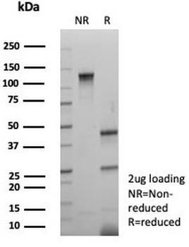 MAP2 Antibody / Microtubule-associated protein 2