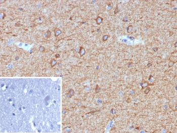 MAP2 Antibody / Microtubule-associated protein 2