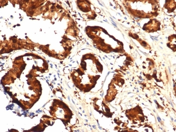 IDH1 Antibody / Isocitrate Dehydrogenase (R132H mutant)