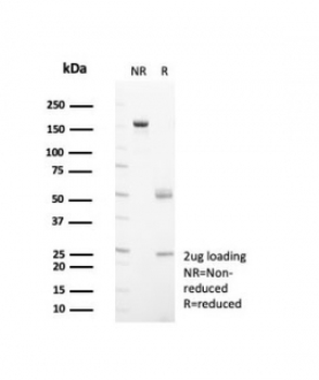 HSP60 Antibody / GROEL
