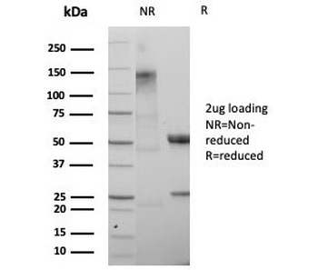 SATB2 Antibody