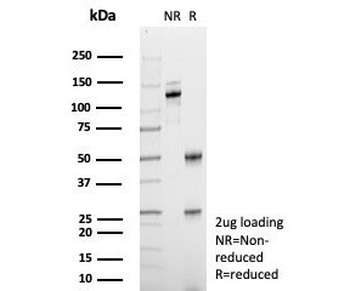 BSEP Antibody / Bile Salt Export Pump / ABCB11