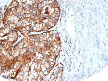 CD26 Antibody