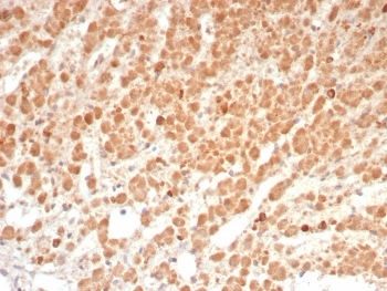IL1 beta Antibody / IL1B