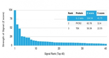 IL1 beta Antibody / IL1B