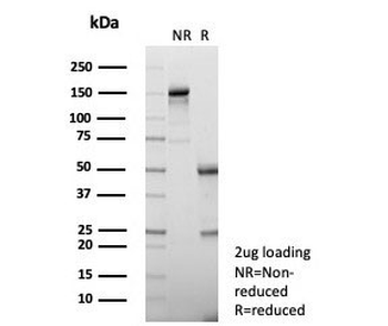 IL1 beta Antibody / IL1B