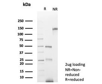 PAX8 Antibody / Paired box protein Pax-8