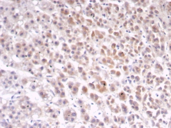 IL1RA Antibody / Interleukin-1 Receptor Antagonist / IL1RN