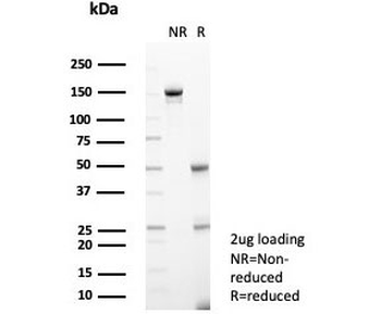 IL1RA Antibody / Interleukin-1 Receptor Antagonist / IL1RN