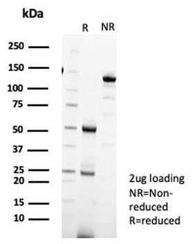 IL18R1 Antibody / Interleukin 18 receptor alpha