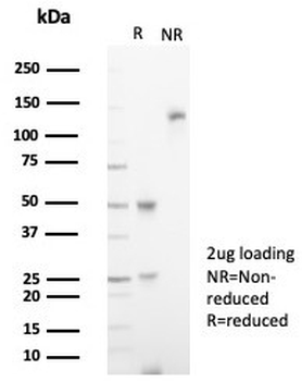 IL18R1 Antibody / Interleukin 18 receptor alpha