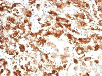 Interleukin 18 receptor alpha Antibody / IL18R1