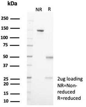IL18R1 Antibody / Interleukin 18 receptor alpha