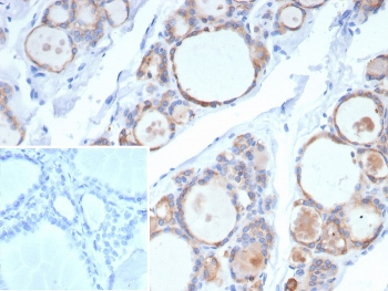 Recombinant TPO Antibody / Thyroid Peroxidase