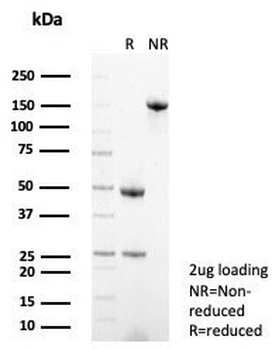 Syndecan-1 Antibody / CD138