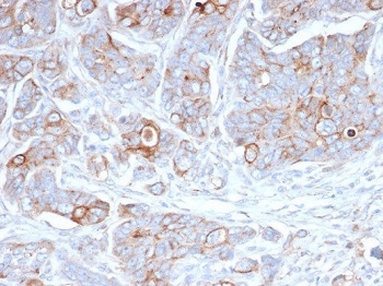 Syndecan-1 Antibody / CD138