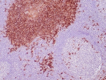 CD138 Antibody / Syndecan-1 / SDC1