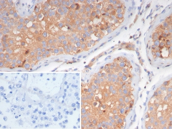 hCG Receptor / LH Receptor Antibody