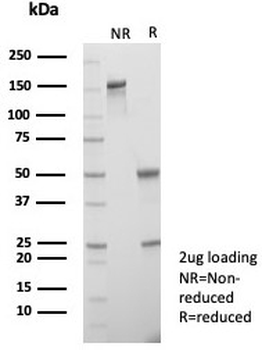 hCG Receptor / LH Receptor Antibody