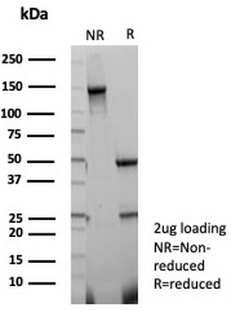 FABP3 Antibody / Cardiac Fatty Acid Binding Protein