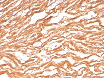 FABP3 Antibody / Cardiac Fatty Acid Binding Protein