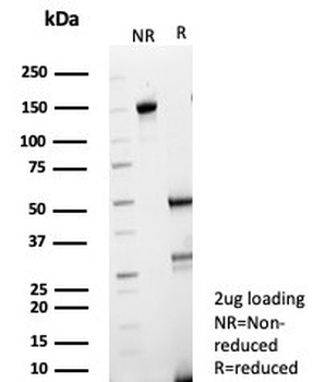 FABP3 Antibody / Fatty Acid Binding Protein 3
