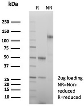 Beta-Parvin Antibody