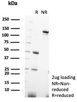 Parvalbumin Antibody