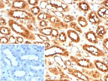MIF Antibody / Macrophage migration inhibitory factor