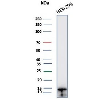 MIF Antibody / Macrophage migration inhibitory factor