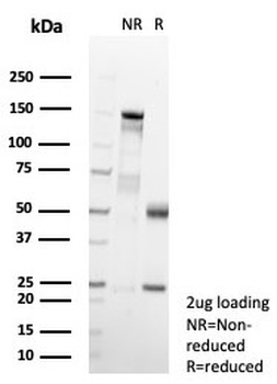 MIF Antibody / Macrophage migration inhibitory factor