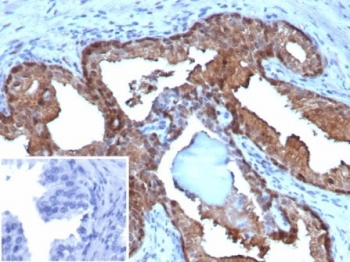 MIF Antibody / Macrophage migration inhibitory factor
