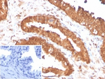 MIF Antibody / Macrophage migration inhibitory factor