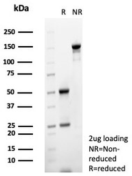 MIF Antibody / Macrophage migration inhibitory factor