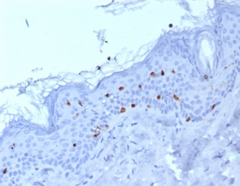 Langerin Antibody / CD207