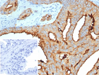 Transmembrane protease serine 2 Antibody / TMPRSS2