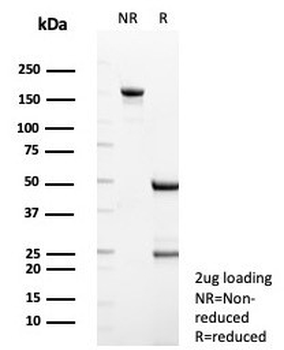 Transmembrane protease serine 2 Antibody / TMPRSS2