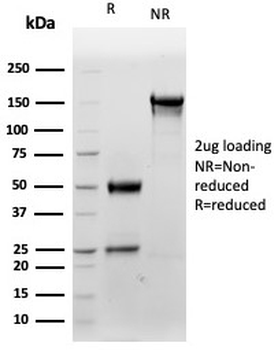 S100B Antibody