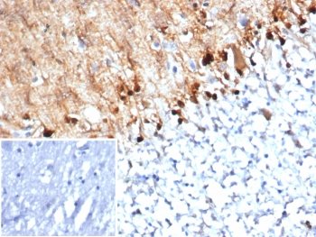 S100B Antibody